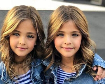 12 Years Ago They Were Called The World’s Most Beautiful Twins – Now Look At Them