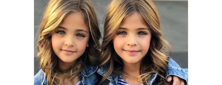 12 Years Ago They Were Called The World’s Most Beautiful Twins – Now Look At Them