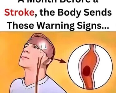 Attention… A Month Before a Stroke, Your Body Sends These Signals…