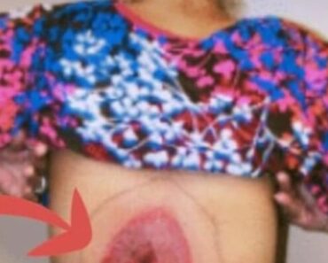 10 Signs Your Body Can Be Signaling a Real Trouble