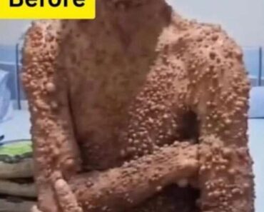 10 Signs Your Body Warns of Trouble